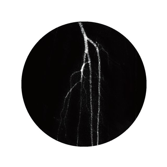 Diz altı arterler anjiyografisi