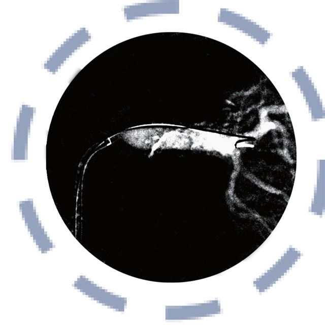 Renal arter anjiyografisi